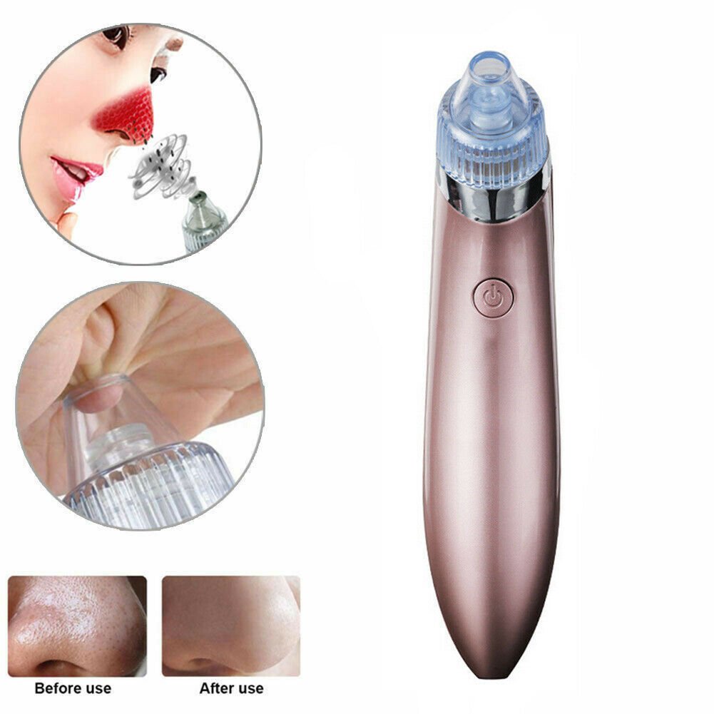Electric Blackhead Vacuum Remover - Treasure Mementos