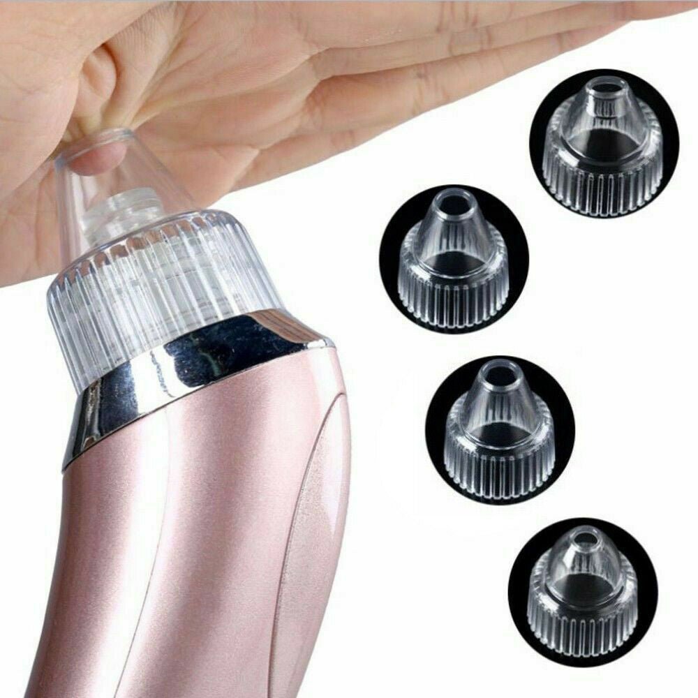 Electric Blackhead Vacuum Remover - Treasure Mementos