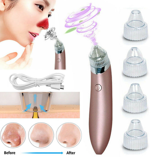 Electric Blackhead Vacuum Remover - Treasure Mementos