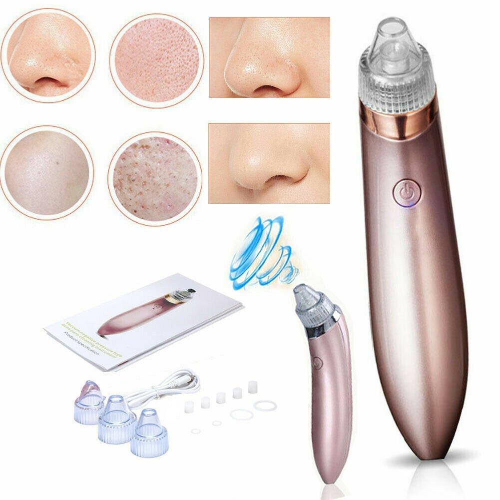 Electric Blackhead Vacuum Remover - Treasure Mementos