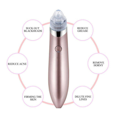 Electric Blackhead Vacuum Remover - Treasure Mementos